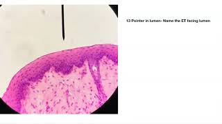 Epithelial Tissue Practice quiz [upl. by Liauqram]