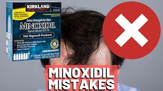 5 BIGGEST MISTAKES When Using Minoxidil REVEALED [upl. by Naga377]