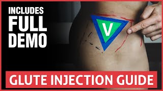 All You Need To Know About Joint Injections [upl. by Johny483]