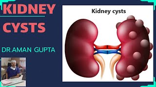 Renal or Kidney CystsSymptomsCauseTreatment [upl. by Bocaj681]