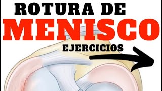 🏋🏻‍♀️ 8 Ejercicios ROTURA de MENISCO [upl. by Edgardo200]