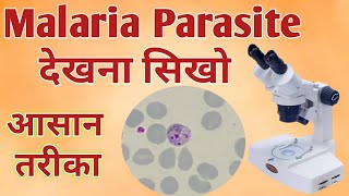 Malaria parasite under microscope  Malaria test  Malaria test procedure [upl. by Ahsei]