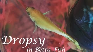 Dropsy in Betta Fish  Symptoms Prevention Life Expectancy amp More [upl. by Allayne709]