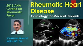 Aortic Stenosis Explained Clearly  Diagnosis and Treatment [upl. by Assil]