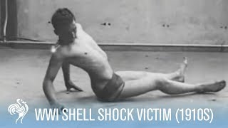 World War 1 Shell Shock Victim Recovery 1910s  War Archives [upl. by Yulma881]