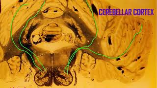 Purkinje cells in the cerebellum [upl. by Eimiaj666]