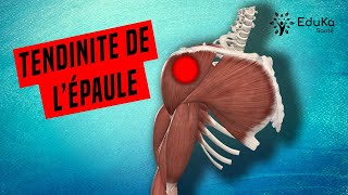 COMPRENDRE LA TENDINITE DE LÉPAULE Explications professionelles [upl. by Nadine]