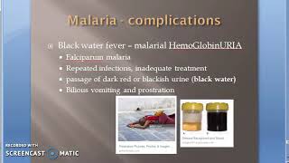 Parasitology 075 i Plasmodium Falciparum Malaria Complication Malignant black water fever algid [upl. by Awahsoj588]