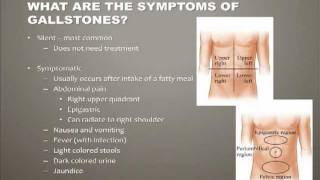 Diseases of the Gallbladder [upl. by Lehte470]