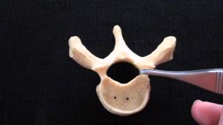 Typical Vertebra  Spinal column  Anatomy [upl. by Enytsirhc]