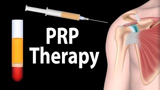 PRP Therapy Animation [upl. by Seuqram564]