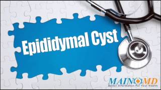 Epididymal Cyst ¦ Treatment and Symptoms [upl. by Ttelrats102]