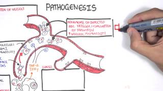 Malaria Pathophysiology [upl. by Alegnad]