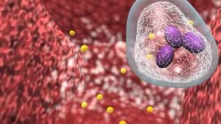 Bacterial infection and host response [upl. by Swartz]