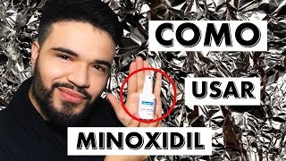 DICAS PARA USAR O MINOXIDIL  dúvidas mais frequentes [upl. by Powel965]