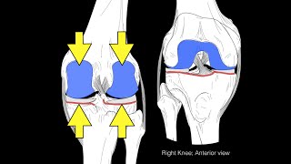 What is Ligament injury  Dr Illavarsan [upl. by Gerick832]