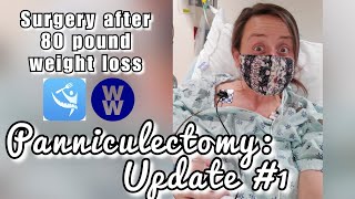 Panniculectomy Recovery Update 1 [upl. by Mosnar836]