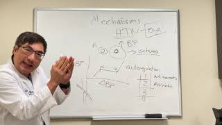 Hypertension and the Eye [upl. by Arriat]