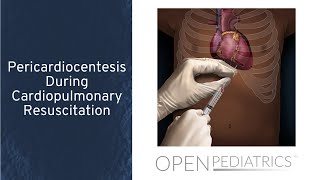 Pericardiocentesis During Cardiopulmonary Resuscitation by T Wolbrink  OPENPediatrics [upl. by Antonin806]