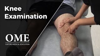 Knee Examination  Orthopaedics [upl. by Orapma]